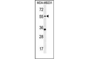Western blot analysis of PDE12 Antibody (C-term) in MDA-MB231 cell line lysates (35ug/lane). (PDE12 抗体  (C-Term))