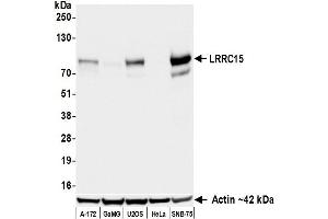 Western Blotting (WB) image for anti-Leucine Rich Repeat Containing 15 (LRRC15) (AA 22-538) antibody (ABIN7795791) (Recombinant LRRC15 抗体  (AA 22-538))