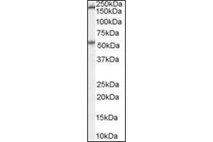 Western Blot Image: Antibody (0. (Serotonin Receptor 3A 抗体  (Internal Region))