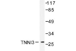 Image no. 1 for anti-Cardiac Troponin I (TNNI3) antibody (ABIN271939) (TNNI3 抗体)