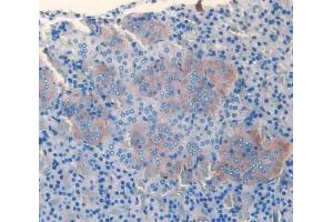 IHC-P analysis of adrenal gland tissue, with DAB staining.