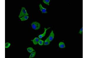 Immunofluorescence staining of MCF-7 cells with ABIN7175658 at 1:100, counter-stained with DAPI. (SORCS1 抗体  (AA 34-175))