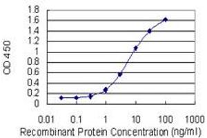 Detection limit for recombinant GST tagged LBX1 is 0. (Lbx1 抗体  (AA 133-219))