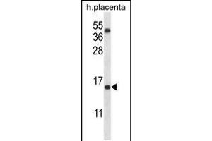 Western blot analysis in human placenta tissue lysates (35ug/lane). (TM4SF18 抗体  (AA 113-141))