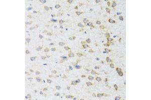 Immunohistochemistry of paraffin-embedded mouse brain using STRN antibody at dilution of 1:100 (x40 lens). (Striatin 抗体)