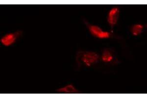 Immunofluorescence (fixed cells) (IF/ICC) image for anti-Zinc Finger, C3HC-Type Containing 1 (ZC3HC1) (C-Term) antibody (ABIN6263640)