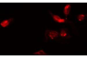 ABIN6272364 staining Hela by IF/ICC. (ZC3HC1 抗体  (C-Term))