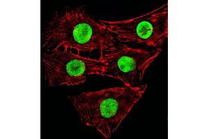 Fluorescent image of C2C12cells stained with Mouse Hmga2 Antibody (C-term) (ABIN6243227 and ABIN6577673). (HMGA2 抗体  (C-Term))