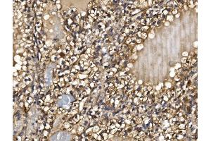 IHC analysis of PMPCA/INPP5 using anti-PMPCA/INPP5 antibody (ABIN7602722). (PMPCA 抗体  (AA 99-525))