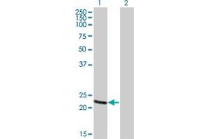 Western Blot analysis of RCV1 expression in transfected 293T cell line by RCV1 monoclonal antibody (M01), clone 4C6. (Recoverin 抗体  (AA 101-199))