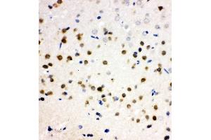 Anti-PLK2 antibody, IHC(P) IHC(P): Rat Brain Tissue (PLK2 抗体  (C-Term))
