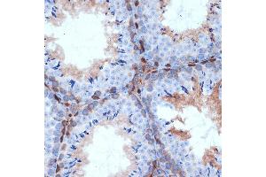 Immunohistochemistry (IHC) image for anti-Protein Kinase C, delta (PKCd) antibody (ABIN7269634)