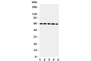 Western blot testing of RGS14 antibody and Lane 1:  rat thymus (RGS14 抗体  (C-Term))