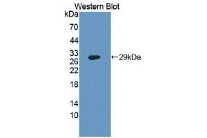 Western Blotting (WB) image for anti-Dipeptidyl-Peptidase 4 (DPP4) (AA 484-728) antibody (ABIN1173872) (DPP4 抗体  (AA 484-728))