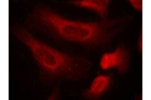 Immunofluorescence staining of methanol-fixed Hela cells using STAT1(Phospho-Ser727) Antibody. (STAT1 抗体  (pSer727))