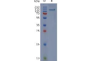 SDS-PAGE (SDS) image for CD93 (CD93) (AA 22-580) protein (mFc Tag) (ABIN7490655)