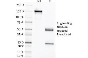 SDS-PAGE Analysis Purified CEA Mouse Monoclonal Antibody (C66/1291). (CEACAM5 抗体)