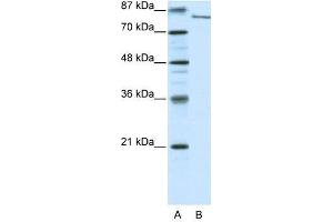 FBXL11 antibody used at 0. (KDM2A 抗体  (N-Term))