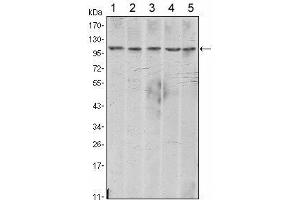 Western Blot showing CDH2 antibody used against A431 (1), NIH/3T3 (2), Hela (3), C6 (4) and LNCap (5) cell lysate. (N-Cadherin 抗体)