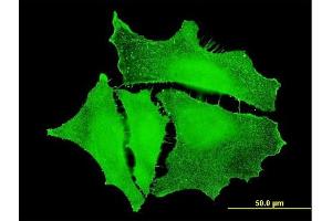 Immunofluorescence of monoclonal antibody to PKP4 on HeLa cell. (Plakophilin 4 抗体  (AA 12-110))