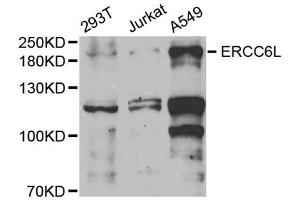 Western blot analysis of extracts of various cell lines, using ERCC6L antibody (ABIN5973617) at 1/1000 dilution. (ERCC6L 抗体)
