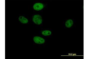 Immunofluorescence of purified MaxPab antibody to TLE3 on HeLa cell. (TLE3 抗体  (AA 1-772))
