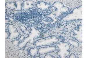 Immunohistochemistry (IHC) image for anti-Plasminogen Activator, Urokinase (PLAU) (C-Term) antibody (ABIN185470)