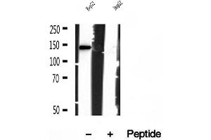Western blot analysis of extracts of HepG2 cells, using IFT140 antibody. (IFT140 抗体  (Internal Region))