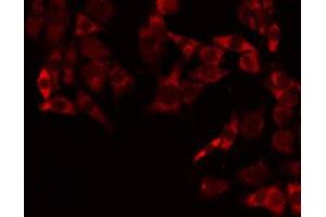 ABIN6275242 staining Hela by IF/ICC. (MRPL3 抗体  (N-Term))