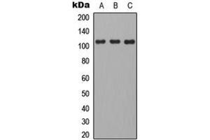 Western blot analysis of CD101 expression in HEK293T (A), mouse brain (B), H9C2 (C) whole cell lysates. (CD101 抗体  (Center))