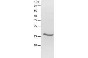 Western Blotting (WB) image for Tumor Necrosis Factor Receptor Superfamily, Member 11b (TNFRSF11B) (AA 201-401) protein (His tag) (ABIN7125547)
