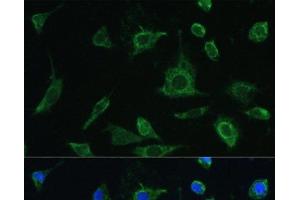 Immunofluorescence analysis of L-929 cells using OSM Polyclonal Antibody at dilution of 1:100. (Oncostatin M 抗体)