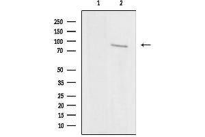 Western blot analysis of lysates from rat brain, using IKBKE Antibody.