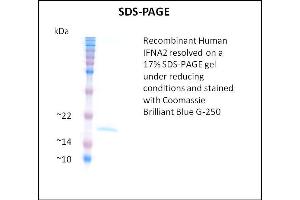 SDS-PAGE (SDS) image for Interferon, alpha 2 (IFNA2) (Active) protein (ABIN5509397)