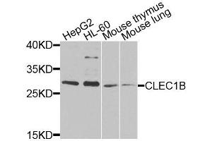Western blot analysis of extracts of various cell lines, using CLEC1B antibody (ABIN6003679) at 1/1000 dilution. (C-Type Lectin Domain Family 1, Member B (CLEC1B) 抗体)