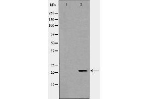 Western blot analysis of Hela whole cell lysates, using DHFR Antibody. (Dihydrofolate Reductase 抗体)