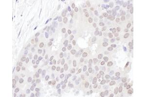 Immunohistochemistry (IHC) image for anti-YLP Motif Containing 1 (YLPM1) (AA 1350-1400) antibody (ABIN7455004)