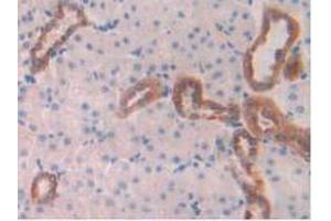 IHC-P analysis of Rat Kidney Tissue, with DAB staining. (Cathepsin D 抗体  (AA 120-407))