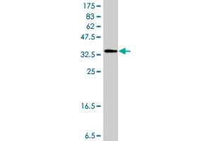 Western Blot detection against Immunogen (37. (FSHR 抗体  (AA 18-120))