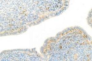 Immunohistochemistry analysis of paraffin-embedded mouse uterus using,NRK (ABIN7074842) at dilution of 1: 1500 (NRK 抗体)