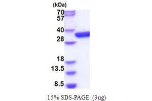 SDS-PAGE (SDS) image for Mitogen-Activated Protein Kinase Kinase Kinase Kinase 3 (MAP4K3) (AA 1-321) protein (His tag) (ABIN5853875) (MAP4K3 Protein (AA 1-321) (His tag))