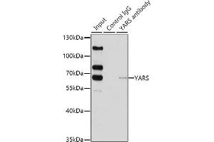 Immunoprecipitation analysis of 200 μg extracts of HeLa cells using 1 μg YARS antibody (ABIN6128883, ABIN6150324, ABIN6150325 and ABIN6222537). (YARS 抗体  (AA 1-300))