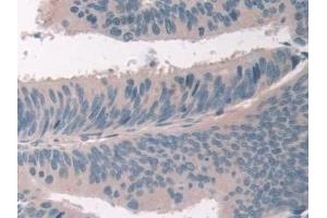 Immunohistochemistry (IHC) image for anti-USP6 N-terminal Like (USP6NL) (AA 1-292) antibody (ABIN7430093)