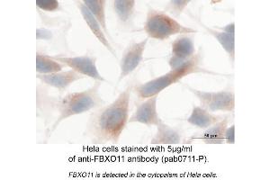 Image no. 2 for anti-F-Box Protein 11 (FBXO11) (Internal Region) antibody (ABIN559708) (FBXO11 抗体  (Internal Region))