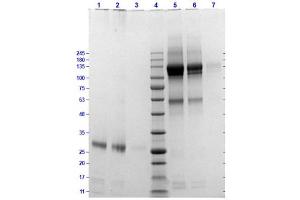 SDS-PAGE Results of Cat F(ab')2 fragment (p/n 002-0104).