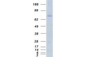 Validation with Western Blot
