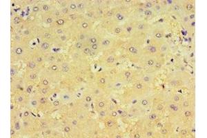 Immunohistochemistry of paraffin-embedded human liver tissue using ABIN7148439 at dilution of 1:100 (CRX 抗体  (AA 120-285))