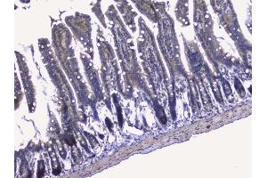 IHC analysis of RALBP1 using anti-RALBP1 antibody (ABIN5692936). (RALBP1 抗体  (AA 239-506))