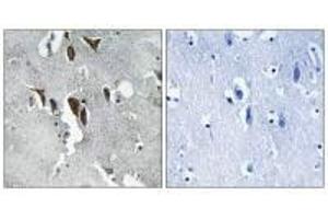 Immunohistochemistry analysis of paraffin-embedded human brain tissue using ELOVL5 antibody. (ELOVL5 抗体)