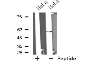 Western blot analysis of extracts from HeLa cells, using GPROPDR antibody. (GPROPDR 抗体)